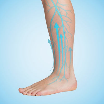 Reduces Swelling and Fluid Buildup